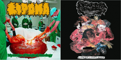 Lipoma : Pseudomonas Aeruginosa - Lipoma